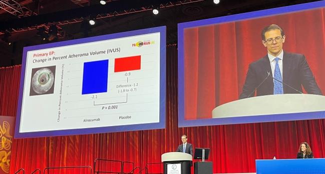 PACMAN-AMI: Positive Plaque Changes With Early Alirocumab Use in Acute MI 