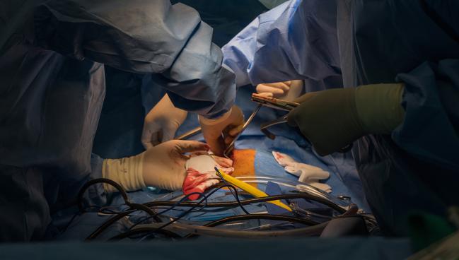 Heart Transplantation After Circulatory Death Gives ‘Encouraging’ Results