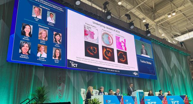 Calcified Nodules Signal Worst Outcome Among OCT-Defined ACS Causes 