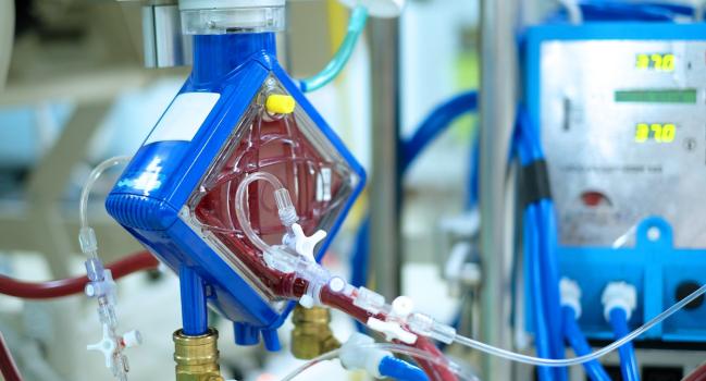 Early ECMO No Better Than Watch-and-Wait Approach in Cardiogenic Shock 