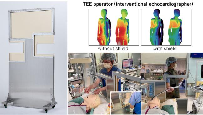 Radiation Exposure Highest for Interventional Imagers at Right Waist and Below