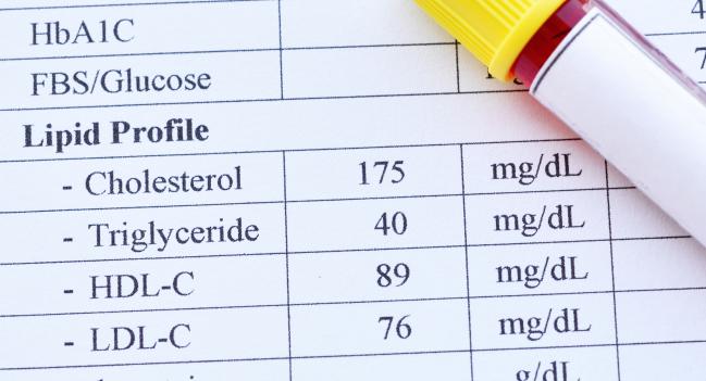 ORION-8: Safe and Durable Longer-Term LDL-Lowering With Inclisiran