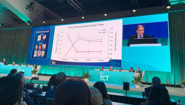 VIVA: No Difference Between TAVI and SAVR for Small Aortic Annuli