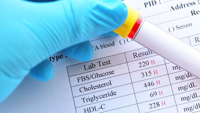 Mortality Risk Varies Among Patients With Very High LDL Levels