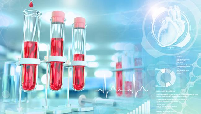 Less Is More: Lp(a) Much More Atherogenic than LDL