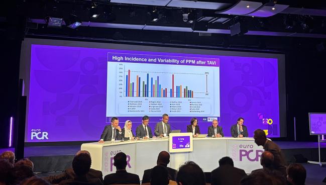 Temporary Pacemaker After TAVI May Preclude Long-term Pacing