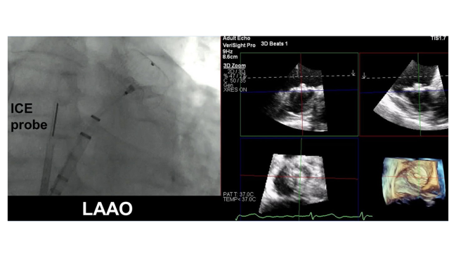 Essentials for 3D-ICE in Structural Interventions Explored in Position Statement