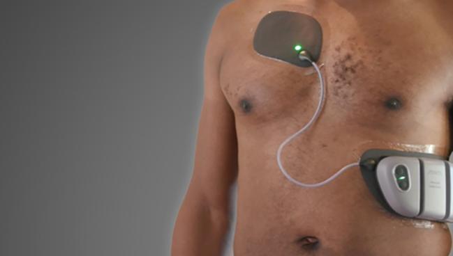 Patch May Prevail Where Prior Wearable Defibrillators Faltered: Jewel IDE Study