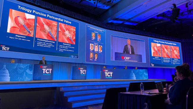 ALIGN-AR at 2 Years Shows Promise for TAVI With Trilogy in Aortic Regurgitation