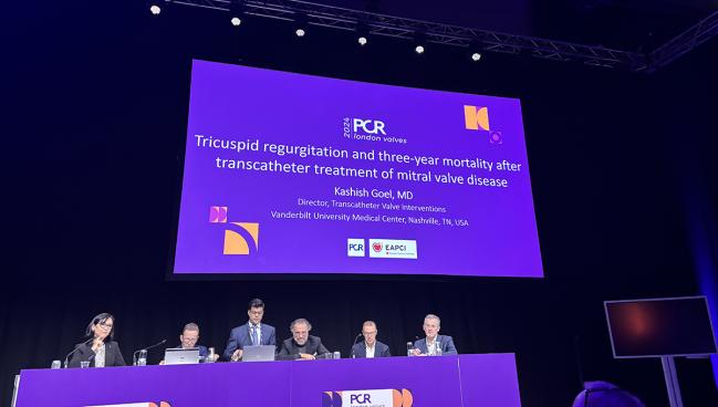 Residual TR After Treating Mitral ViV Disease Linked to Worse Outcomes