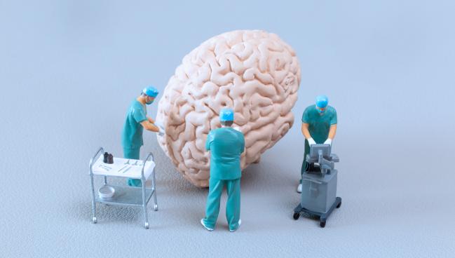 Stroke Thrombectomy Doesn’t Help for Blockages in Smaller Vessels