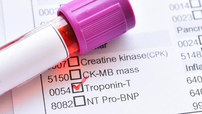 High-Sensitivity Troponin Tests Might Aid in Primary Prevention