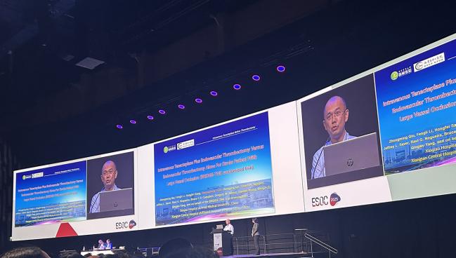 IV Tenecteplase Helps Before Stroke Thrombectomy: BRIDGE-TNK