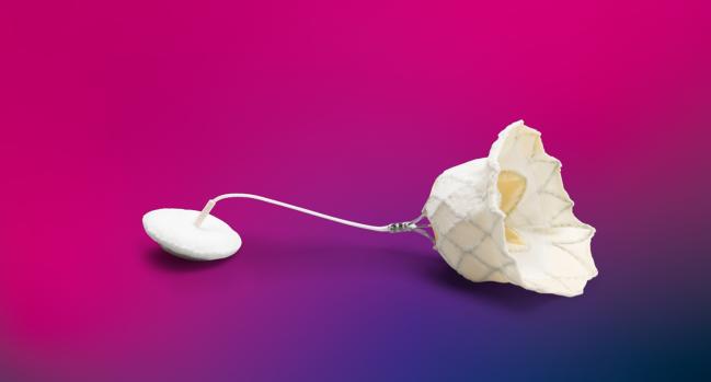 Tendyne Approved in US for High-risk Patients With Mitral Valve Disease