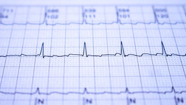 AF Touted as ‘Bad Player’ in Patients Undergoing Mitral TEER