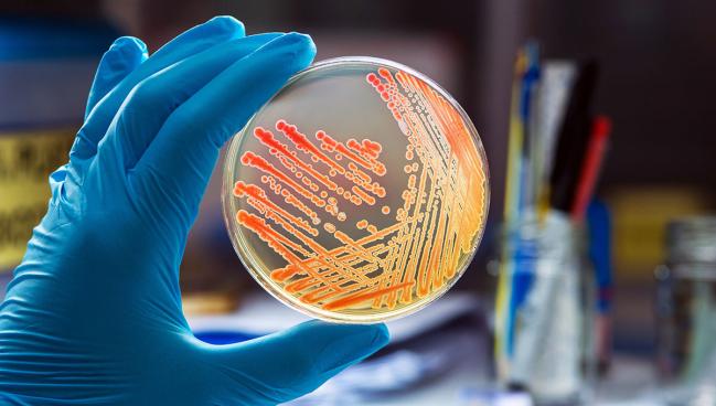 Infective Endocarditis Risk Much Higher a Decade After MV Replacement vs Repair