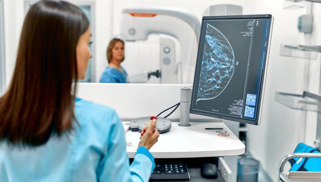AI Tool Supports Mammograms as Method to Screen Women for CV Risk
