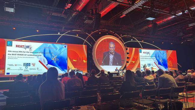 BEAT PAROX-AF: Pulsed-Field Ablation Not Superior to Radiofrequency