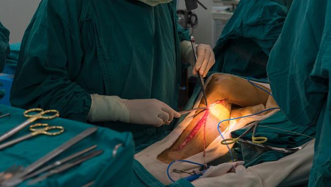 NEWTON-CABG CardioLink-5: Evolocumab Doesn’t Prevent SVG Failure