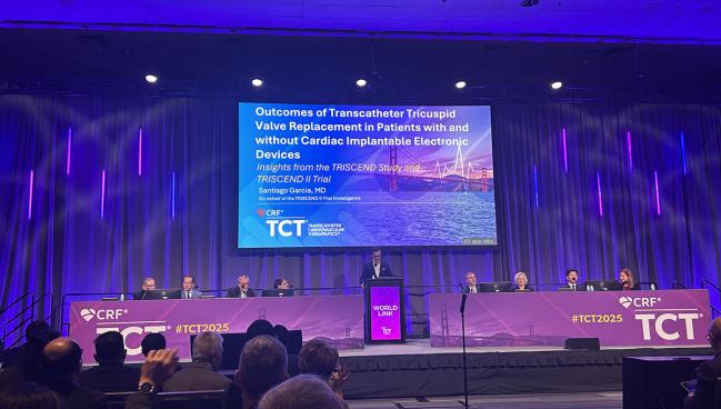 TTVR Remains Safe, Effective in Presence of CIED Leads