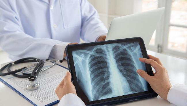 Chest X-ray Before Cath—Is There a Point?