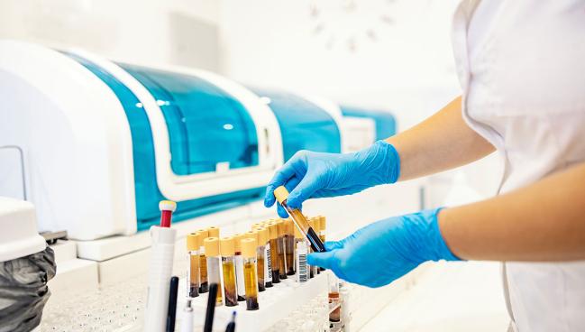 Patient Age Adds Key Context to D-Dimer in DVT Diagnosis: ADJUST-DVT