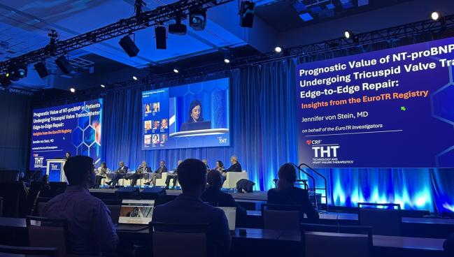 NT-proBNP Provides Info on Who Will Fare Well After Tricuspid TEER