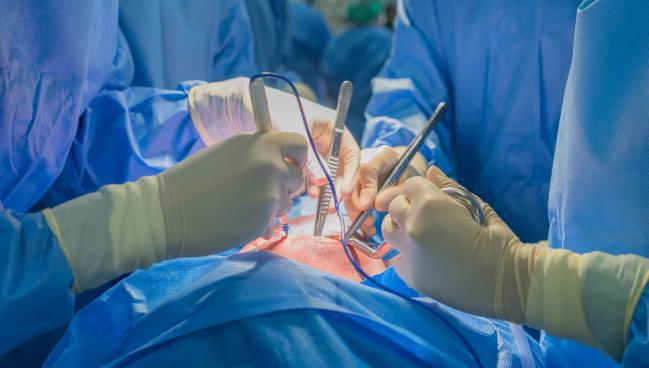 Outcomes Steady as Hearts Donated After Circulatory Death Rise in the US