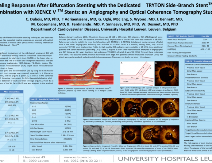 Healing Responses After Bifurcation Stenting with the Dedicated TRYTON Side-Branch Stent in Combination with XIENCE V Stents: an Angiography and Optical Coherence Tomography Study.