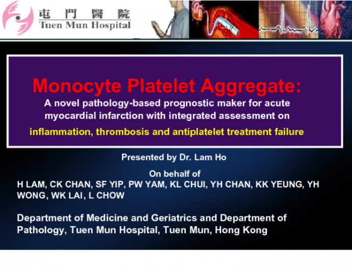 Monocyte Platelet Aggregate act as Platelet Function Assay and Prognostic Marker for Acute Myocardial Infarction.