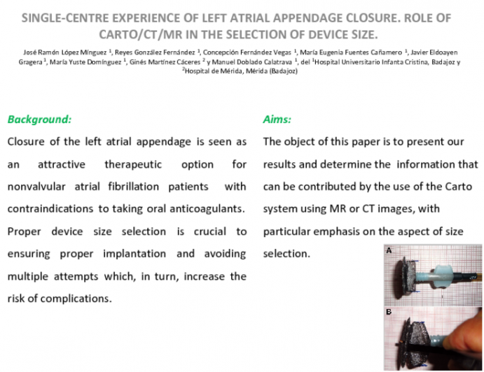 Single-Centre Experience of Left Atrial Appendage Closure. Role of Carto/CT/MR in the Selection of Device Size.