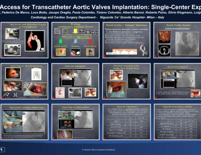 TRANS-AORTIC ACCESS FOR TRANSCATHETER AORTIC VALVES IMPLANTATION: SINGLE CENTRE EXPERIENCE