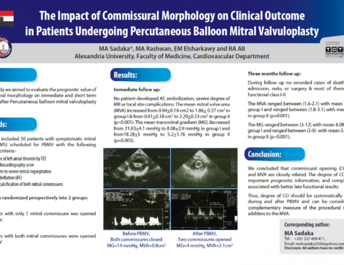 The Impact of Commissural Morphology on Clinical Outcome in Patients Undergoing Percutaneous Balloon Mitral Valvuloplasty