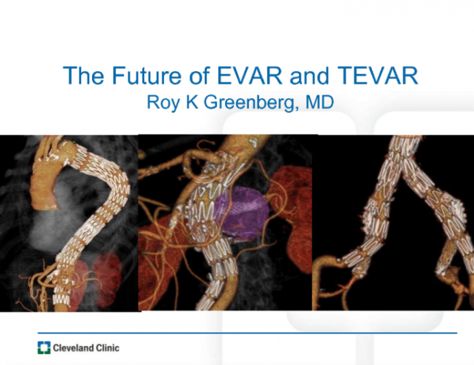 EVAR and TEVAR: Future Directions