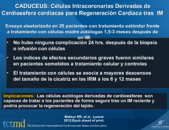 CADUCEUS: Células Intracoronarias Derivadas de Cardioesfera cardíacas para Regeneración Cardíaca tras  IM