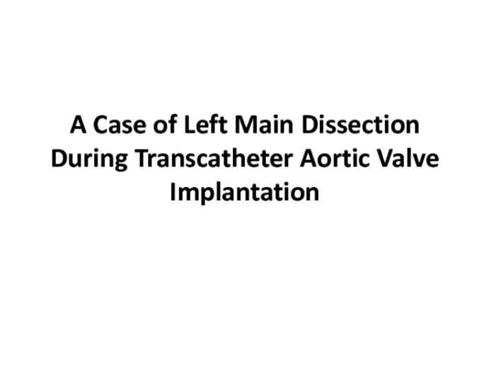 Left Main PCI Complications: A Series of Cases