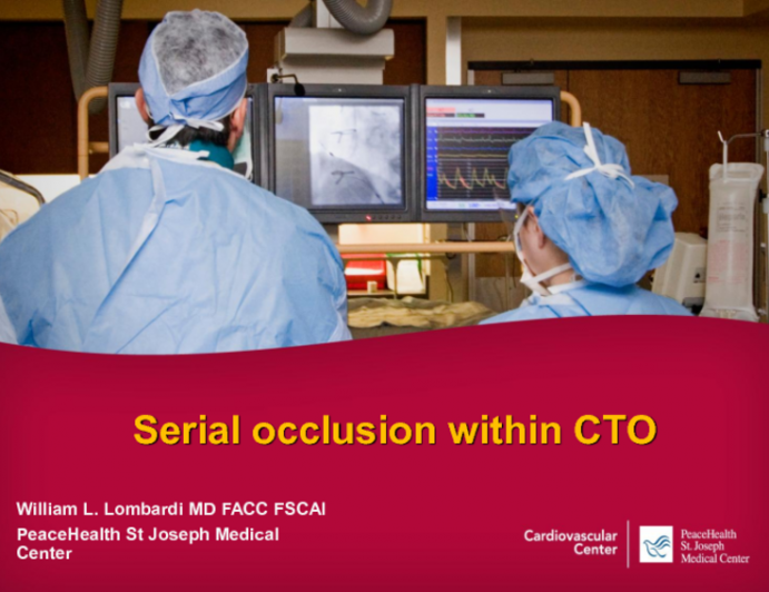 Special Approaches for Serial Occlusions (with Case Examples)