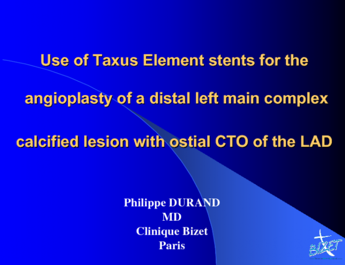 Use of Taxus Element Stents for the Angioplasty of a Distal Left Main Complex Lesion with Ostial CTO of the LAD