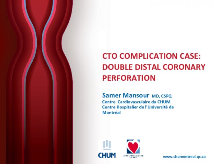 Successful Management of Double Distal Coronary Perforation with Selective Gelfoam Embolization