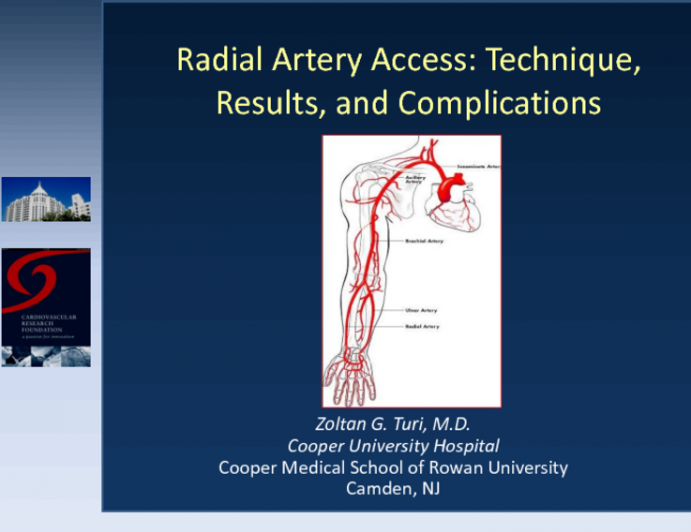 Radial Artery Access: Technique, Results, and Complications