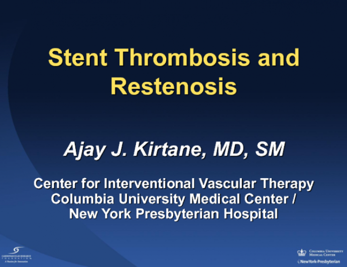 Stent Restenosis and Thrombosis: Etiology, Treatment, and Outcomes