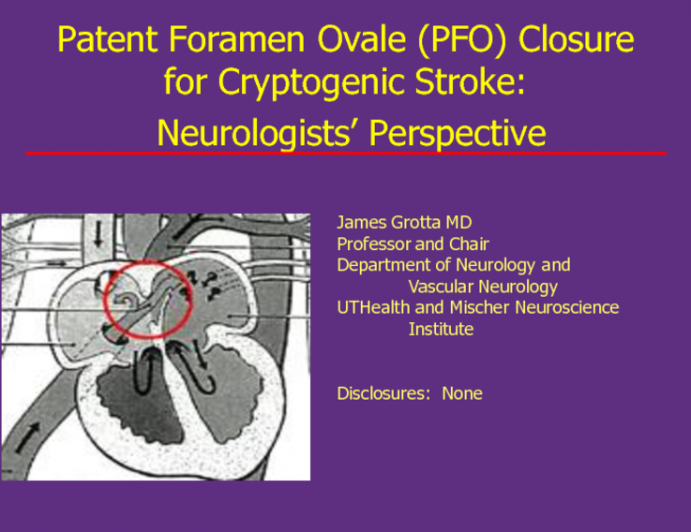 Patent Foramen Ovale (PFO) Closure for Cryptogenic Stroke: Neurologists’ Perspective