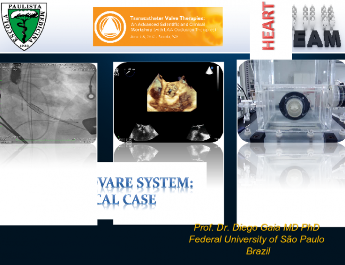 TF Braile TAVR System: Taped Case, Design and Function, and Clinical Outcomes