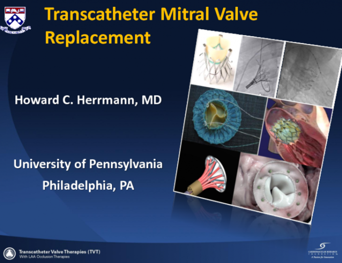 Transcatheter Mitral Valve Replacement: Rationale, Hurdles, and Contenders