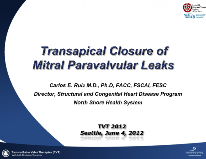 Apical Closure of Mitral Leaks