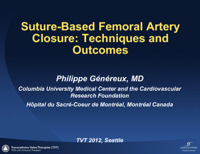 Suture-Based Femoral Artery Closure: Techniques and Outcomes