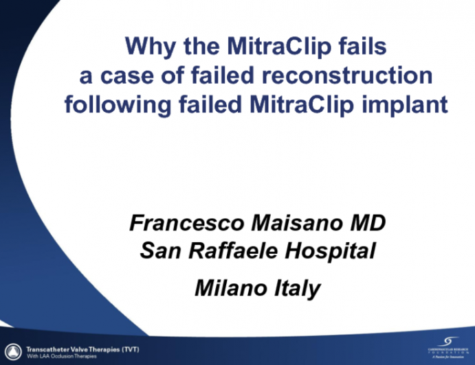 Case Study 3: Failed Mitral Valve Surgery After a Failed MitraClip