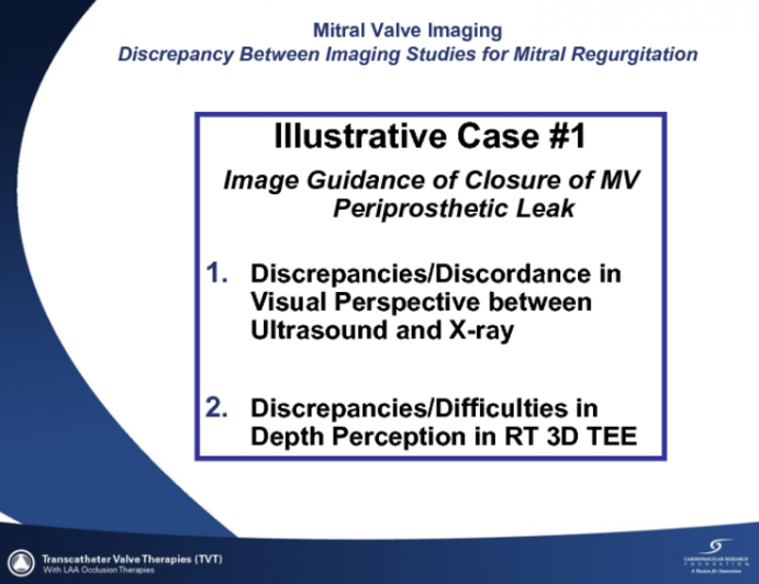 Case Study 1: Discrepancy Between Imaging Studies for MR