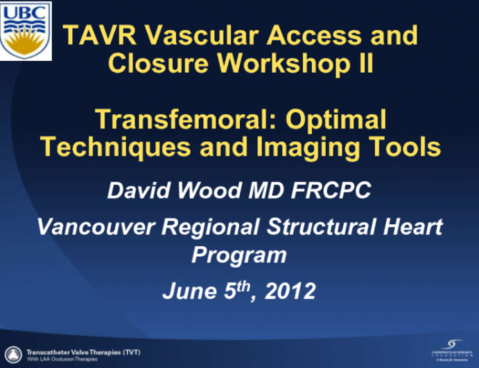 Optimal Techniques and Imaging Tools for Common Femoral Artery Puncture(2)