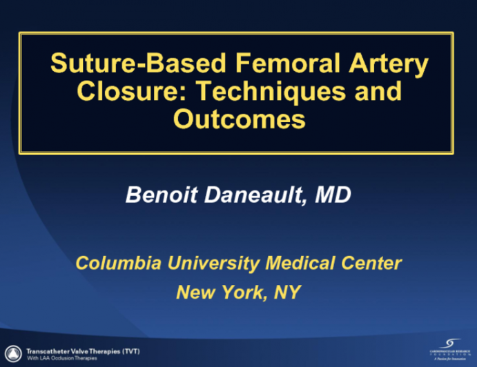 Suture-Based Femoral Artery Closure: Techniques and Outcomes(2)